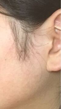 女ですもみあげを全剃りしてしまってここまで伸ばしたんですがもみあげの横 Yahoo Beauty