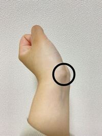 左手首の親指側 が骨がボコって出ているんですけどこれってガング Yahoo 知恵袋