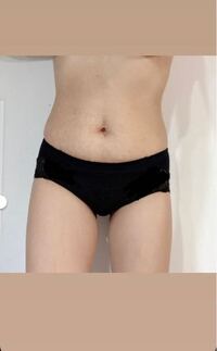 閲覧注意 お腹たるみ過ぎて未婚の代からしたら笑えるレベルですか Yahoo 知恵袋