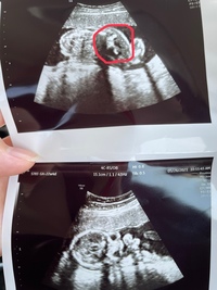 こんにちは 22週の初妊婦です 本日産婦人科に行ってきました 18週の時 Yahoo 知恵袋