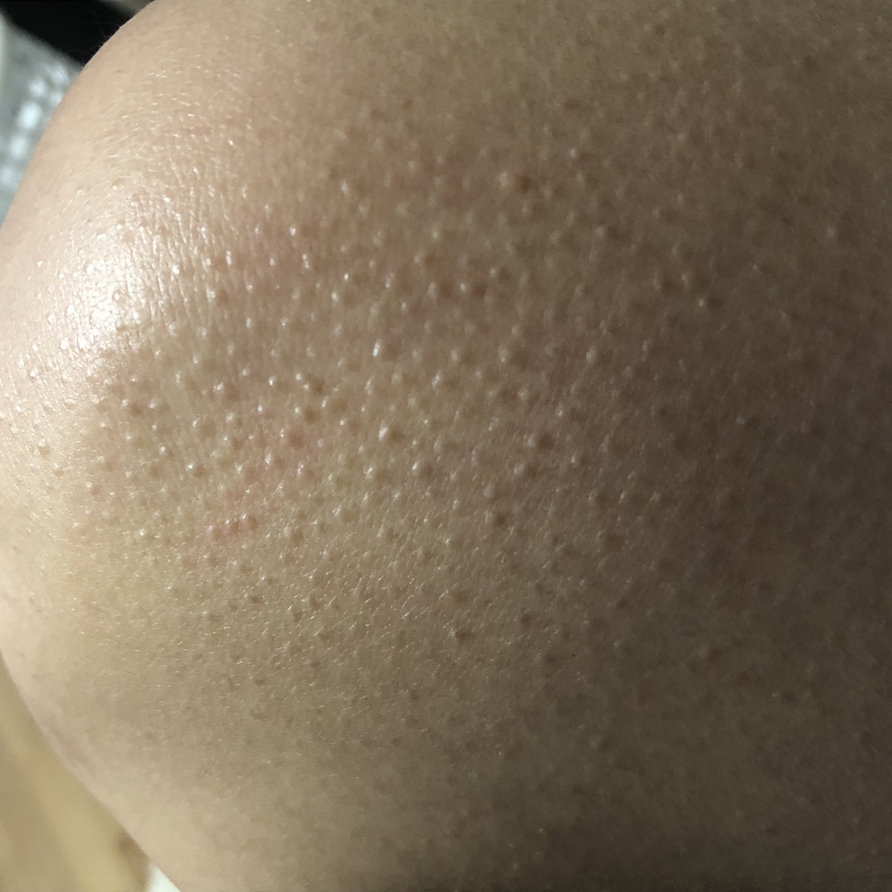 お見苦しい写真すみません 足の毛をカミソリで剃るよう Yahoo 知恵袋