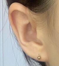 ピアスの位置が非対称 右耳だけしこりがあり中々安定しないという理由でピア Yahoo 知恵袋