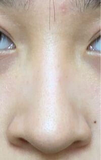 ノーズシャドウとハイライト 軽く をしてるんですけど 不自然じ Yahoo 知恵袋