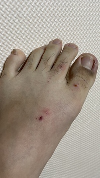 皮膚に赤い湿疹ができて痒いです この赤い湿疹が腕や肘 顔にもで Yahoo 知恵袋