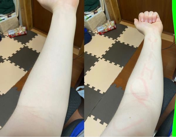 顔の毛穴をなくすのって自力じゃ無理ですか 透明感のある肌になりたいです Yahoo 知恵袋