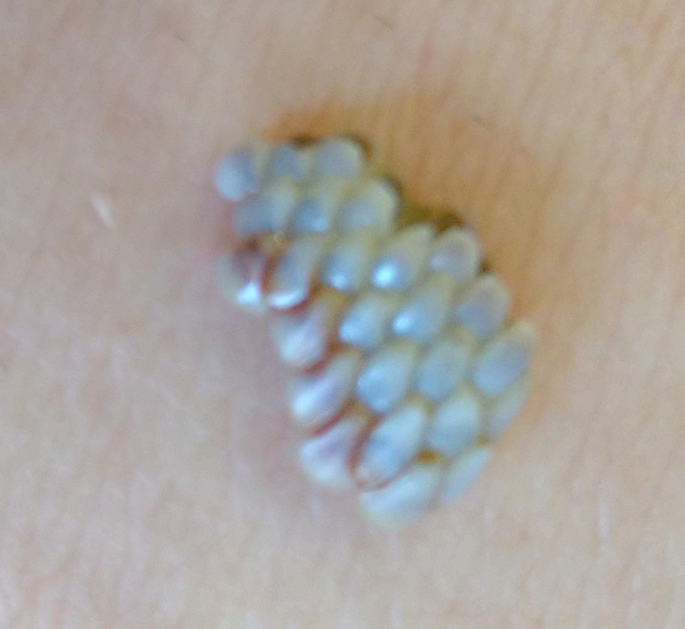 沖縄の本部で ウツボを獲りました 食べようと思うのですが 毒 Yahoo 知恵袋