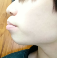この横顔って アデノイド たらこ唇ってやつですよね Yahoo 知恵袋