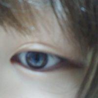 アイプチなどをやり過ぎると まぶたの皮膚が伸びるってよく聞きますが Yahoo 知恵袋