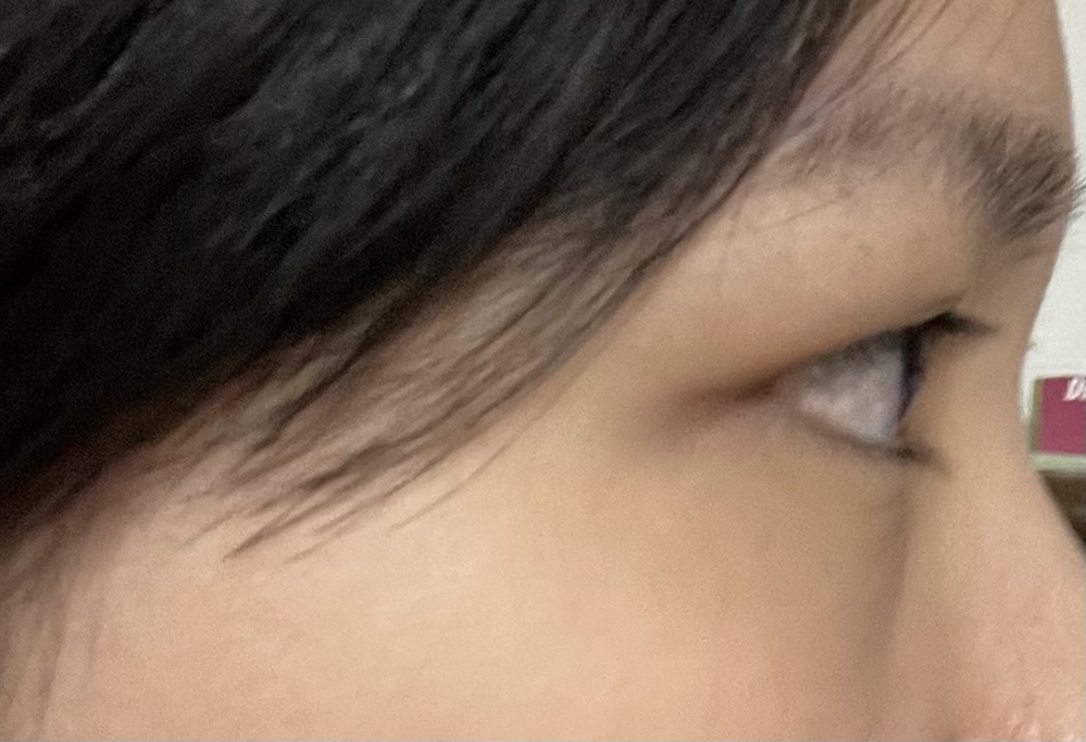 これで出目か奥目かわかりますか 別に普通だと思いますが横顔だけなの Yahoo 知恵袋