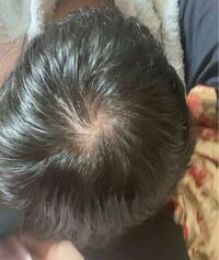 お風呂上がりなんですけど ヤバいですかね つむじは2つあ Yahoo 知恵袋