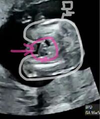 こんにちは17週の妊婦です男の子がすでに2人います 検診で性別 Yahoo 知恵袋