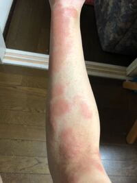 助けてください この前夜遅くまで診療をしている緊急で行った皮膚科で塗り薬 Yahoo 知恵袋