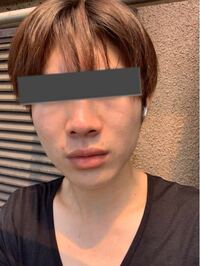 歳男です 肌がたるんでてゴルゴラインやほうれい線が出てきて悩ん Yahoo 知恵袋