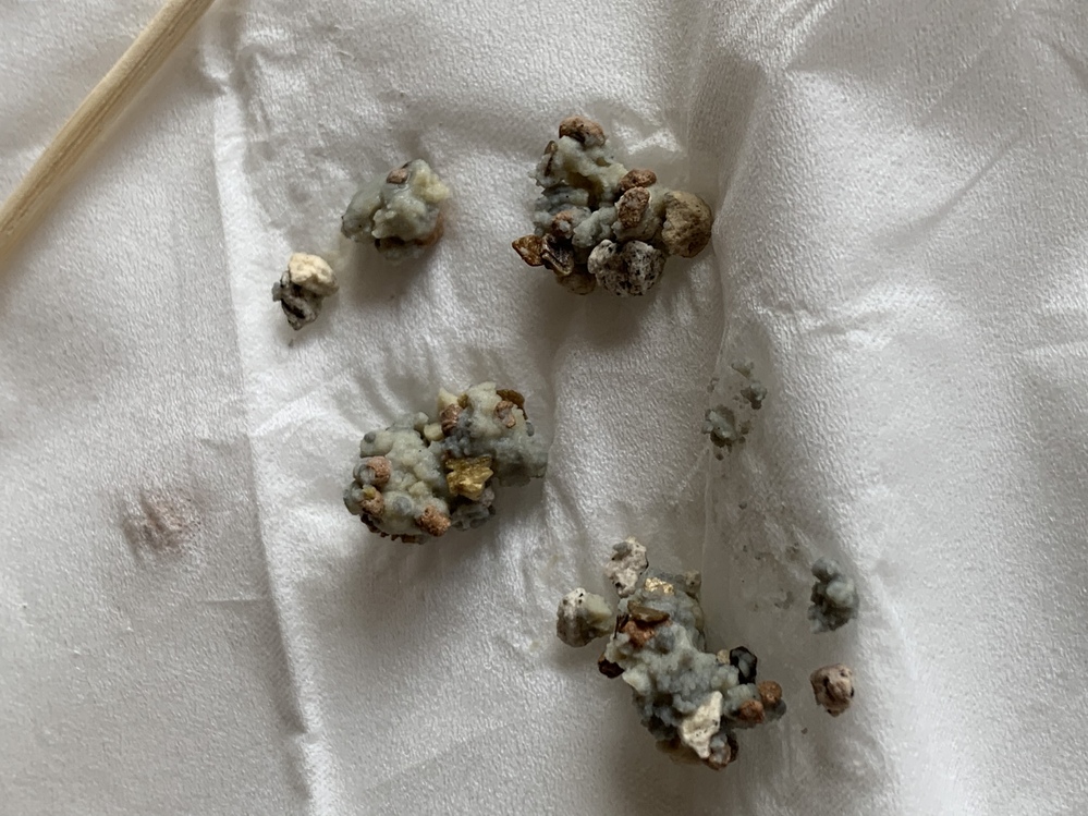 観葉植物の土に灰色のつぶつぶ がたくさんありました これはなん Yahoo 知恵袋