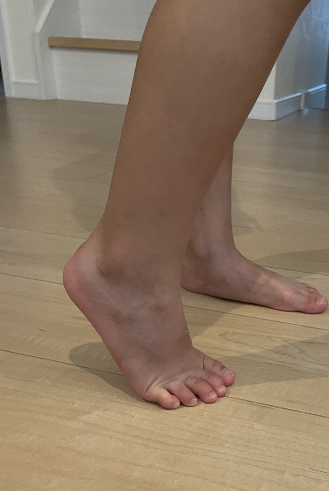 子供の成長痛について 4歳の息子が先週あたりから右足が痛 Yahoo 知恵袋