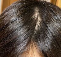 髪を分けると頭皮が見えます 風が吹いてる日 日差しが強い日は最 Yahoo 知恵袋