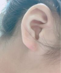 ピアスを開けて2週間ちょっとが経ったのですが 腫れが引きません Yahoo 知恵袋