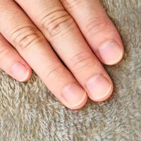 深爪と爪弄りを直したいです 10年以上爪噛みをしていまし Yahoo 知恵袋