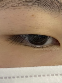 これって逆さまつげでしょうか まつ毛が上がらなくて悩んでます Yahoo 知恵袋