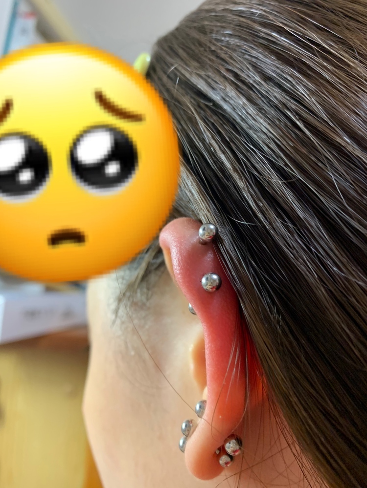 ピアスをあけたことによって起きた 面倒なこと 嫌なことを教えてください Yahoo 知恵袋