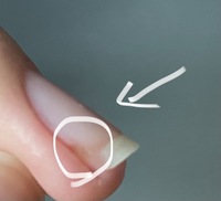 左手薬指の爪の下に膿があるんですがひょうそってやつですか ネイルオ Yahoo 知恵袋