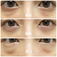 東京中央美容外科の評判はどうなんでしょうか 最近新しく出来た東京中央美容 Yahoo 知恵袋