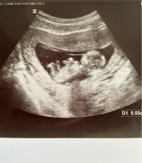 現在妊娠12週目です 本日検診だったのですが このエコー写真はベビ Yahoo 知恵袋