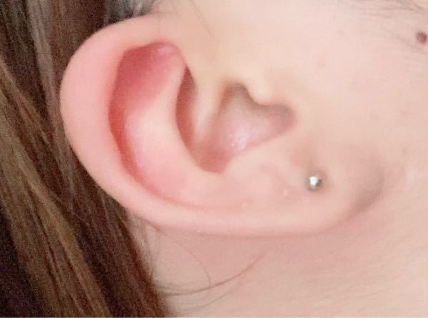 ピアスバイトだめで夏休みに開けようと思うんですけど穴が安定するまで付けとかな Yahoo 知恵袋