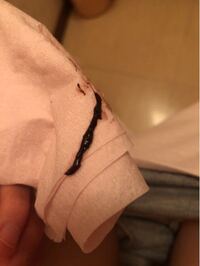 汚い画像ですみません 3週間前からこのような黒い織物が出ます こ織物 Yahoo 知恵袋