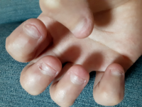 ストレスを感じると無意識に爪を噛んでしまう癖があって今高１で写 Yahoo 知恵袋