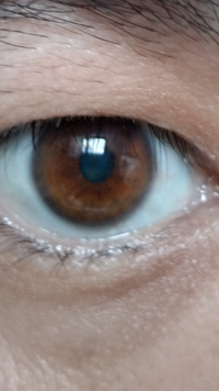 小さい頃から 目が綺麗と目だけは誰からでも ほめられるけど その理由知り Yahoo 知恵袋