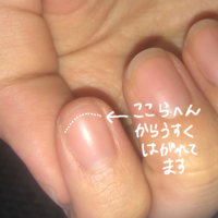 急につめの伸びてる部分が綺麗に取れちゃったのですが 何が原因か Yahoo 知恵袋