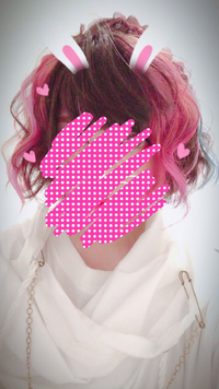 このnqrseちゃんなんですけど 首元に赤のがあって 肌が弱いのかなと疑 Yahoo 知恵袋