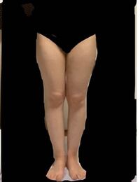 身長１５０cmで体重４５kgは 肥満気味ですか １５０cmの理想 Yahoo 知恵袋