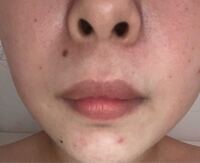 ほくろ占いできる方に見て頂きたいです 口の右上のほくろには何か意味 Yahoo 知恵袋