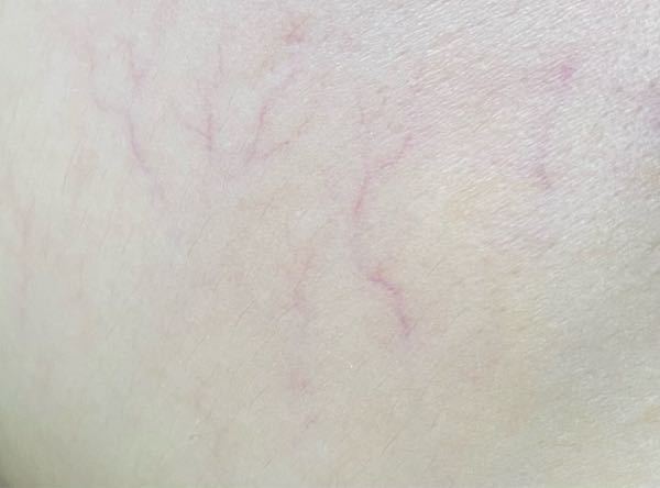 Chie Pctr C Yimg Jp Dk Iwiz Chie Que