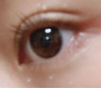 画像ありです 目の周り 下 に白いぶつぶつがあってこれはなんで Yahoo 知恵袋