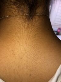 高校女子ですがさすがに背毛やばいですよね 何かいい処理方法 Yahoo 知恵袋