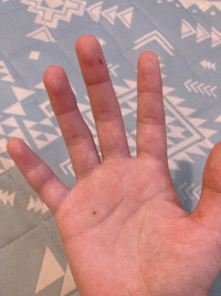 手の内側に二つほくろがあります 写真のような感じで中指と手のひ Yahoo 知恵袋