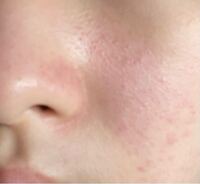 キールズのスキンケアを買おうと思っています 肌質的にはイ Yahoo 知恵袋