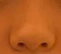 団子鼻と豚鼻とにんにく鼻どれですか？鼻がかなり上向きになってると思うんですけど、改善マッサージありますか？？また、顔痩せすれば多少鼻が小さくなりますか？？ 