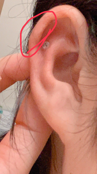 ピアスを開けて1週間がたちました ピアスを開けた日は開け Yahoo 知恵袋