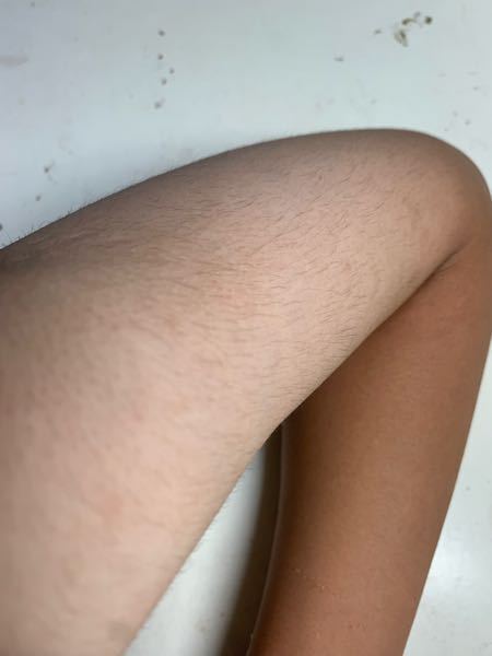 女子高生　陰毛 女子高生でこの体毛って相当毛濃いですよね、 - 脱毛行く時間もお金もなく... - Yahoo!知恵袋