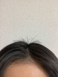 髪の分け目にこのようなアホ毛があるのですが伸びるまで待つしかないですか Yahoo 知恵袋