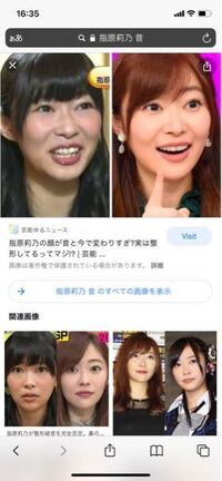 指原莉乃さん整形してると思いますか Youtubeのコメント欄で整 Yahoo 知恵袋