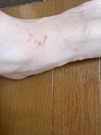 今年の8月8日に新潟県上越市の海に行き泳いでるときにクラゲに刺されたとこ Yahoo 知恵袋