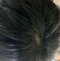 高校生です 白髪多いですよね もっと多いやつもいます 気にしすぎる Yahoo 知恵袋