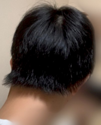 襟足がキモすぎて耐えられません 僕の襟足は今写真のものを Yahoo 知恵袋