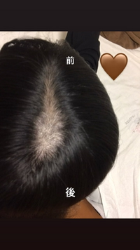 高校2年生女子ですこれはやばいですか アホ毛を抜いたり切ったり Yahoo 知恵袋