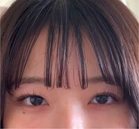 自分の二重幅が左右非対称で嫌いです 変ですよね なかなか治らな Yahoo 知恵袋